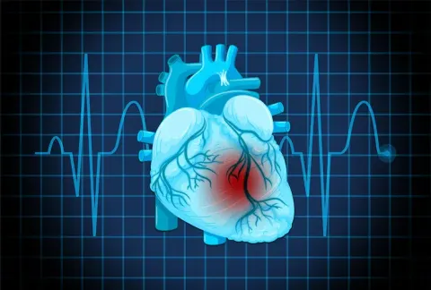 Heart Failure: Guide to Symptoms, Causes, Diagnosis, Treatment and Prevention
